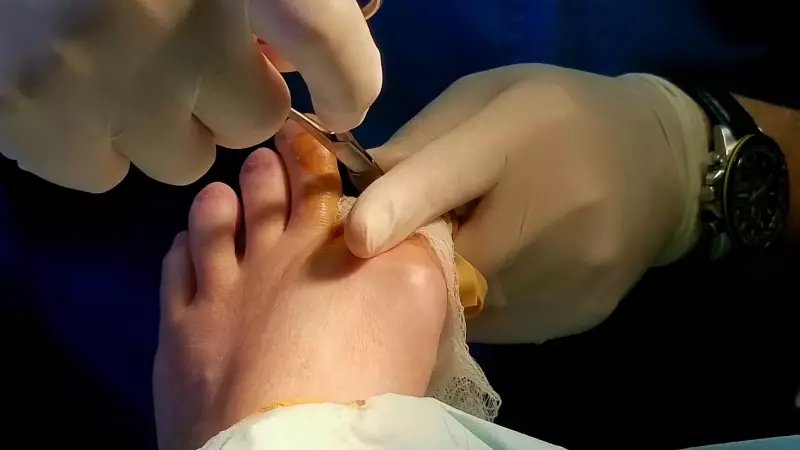 56-Year-Old Diabetic's Shoe Bite Leads to Amputation: A Stark Warning
