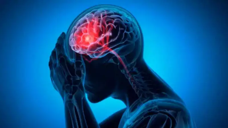 Brain Stroke Prevention: 6 Essential Strategies to Protect Your Health