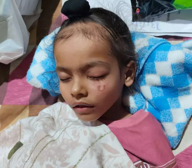 Festive Boom Turns to Gloom: PGI Chandigarh Reports Alarming Spike in Diwali Firecracker Injuries