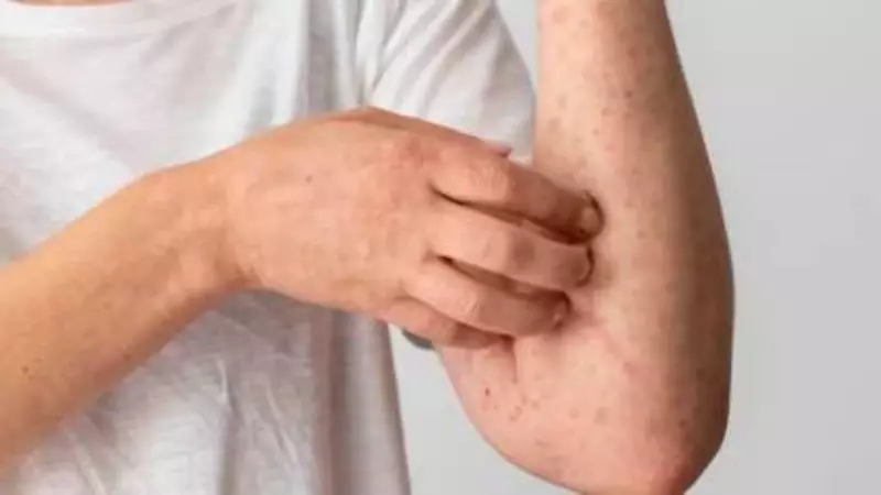 India's Fungal Infection Crisis: Will ICMR's Lab Network Merger Impact Research?