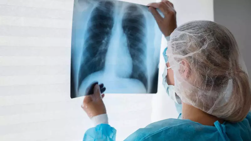 India's TB Battle: Progress Made But 2025 Elimination Target Remains Distant