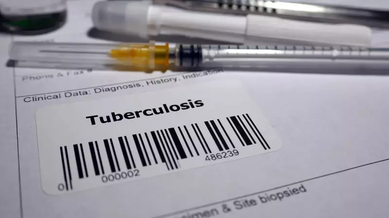 India's TB Fight: Progress Made, But More Work Needed