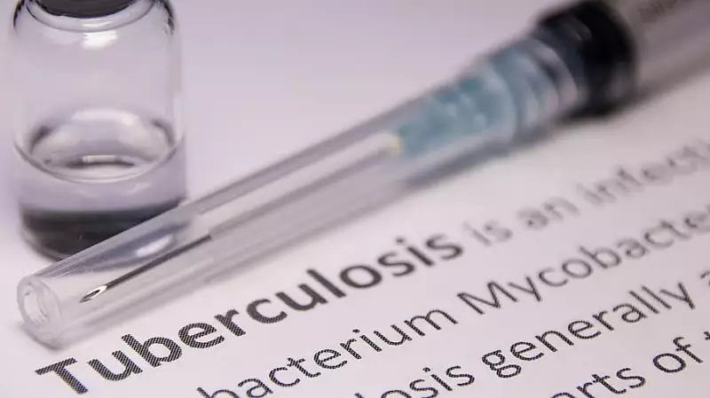 Karnataka TB Institute Dissolved: What It Means for Public Health