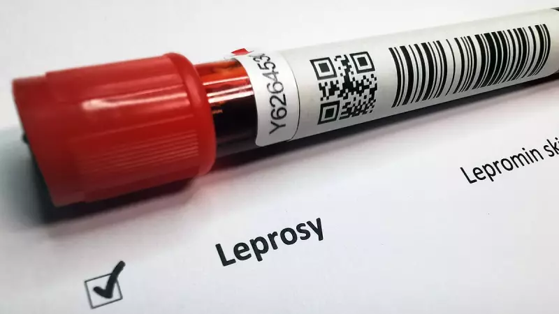 Maharashtra Takes Historic Step: Leprosy Now a Notifiable Disease Across the State