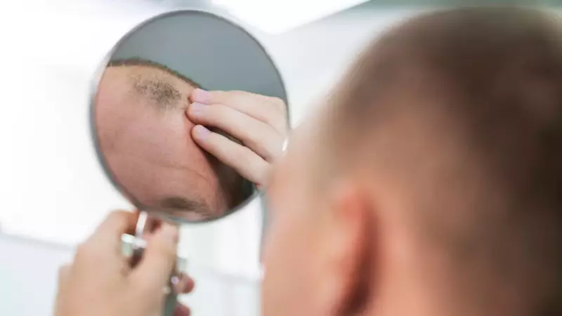 New Hair Loss Drug Shows Promise in Phase 3 Trials: A Potential First in 30 Years