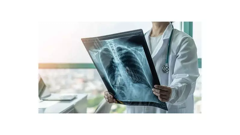 PGIMER Sounds Alarm: Deadly Superbug Detected in Hospital's Heart Unit