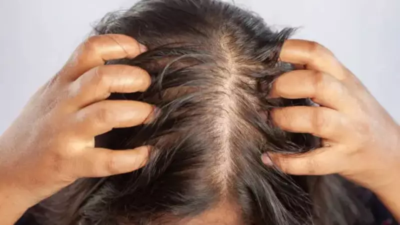 Sugar and Hair Loss: The Surprising Connection Explained