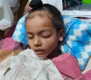 Festive Boom Turns to Gloom: PGI Chandigarh Reports Alarming Spike in Diwali Firecracker Injuries