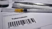 India Records Highest Global Tuberculosis Cases in 2024: WHO