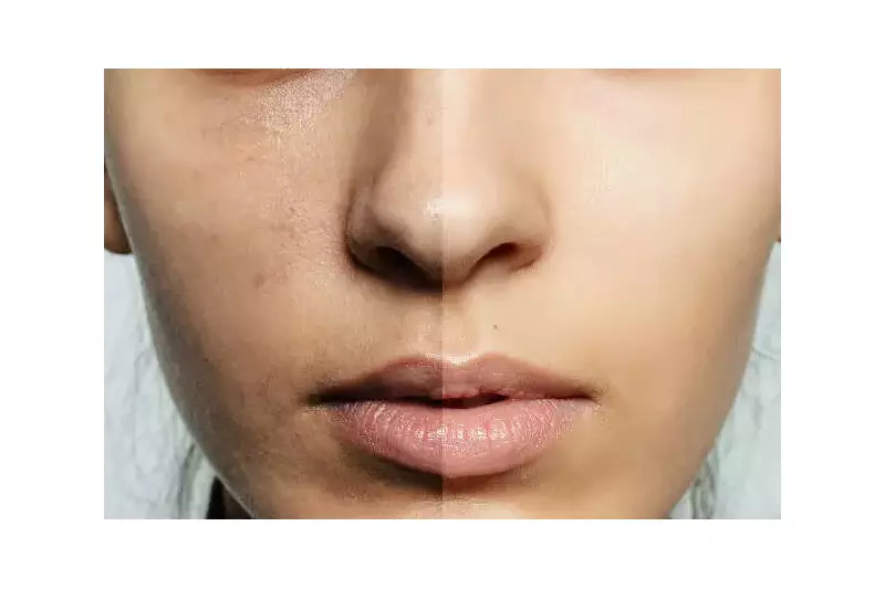 Glow From Within: 5 Glutathione-Rich Foods For Radiant Skin You Must Try!