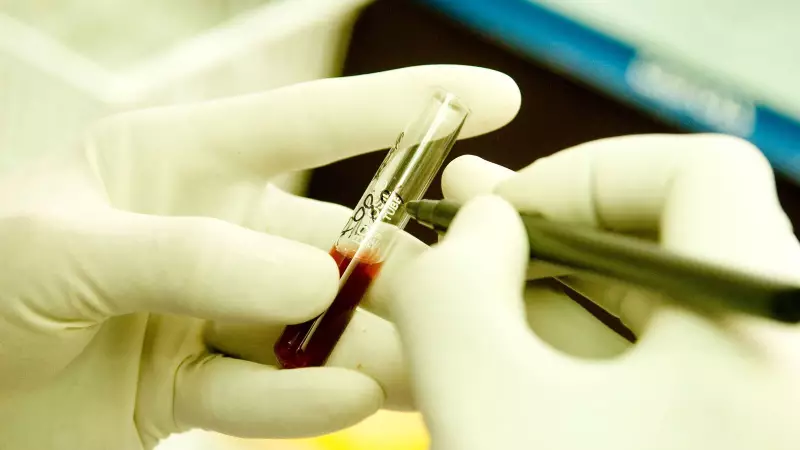 Jharkhand Medical Horror: 5 Thalassemia Children Contract HIV Through Tainted Blood Transfusions in Chaibasa