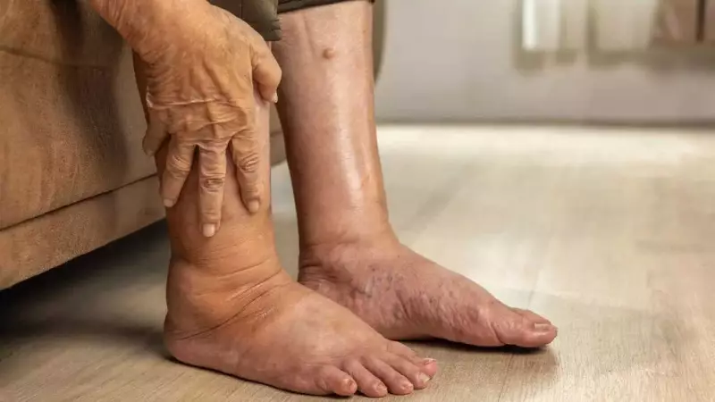 Pancreatic Cancer Alert: 4 Leg Symptoms You Must Not Ignore