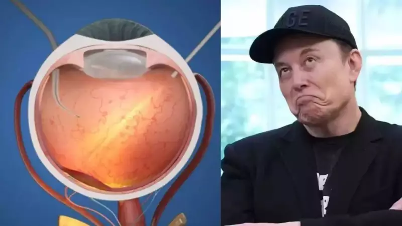 Prima Retinal Implant Breakthrough: Blind Patients Read and See Again, Challenging Elon Musk's Neuralink