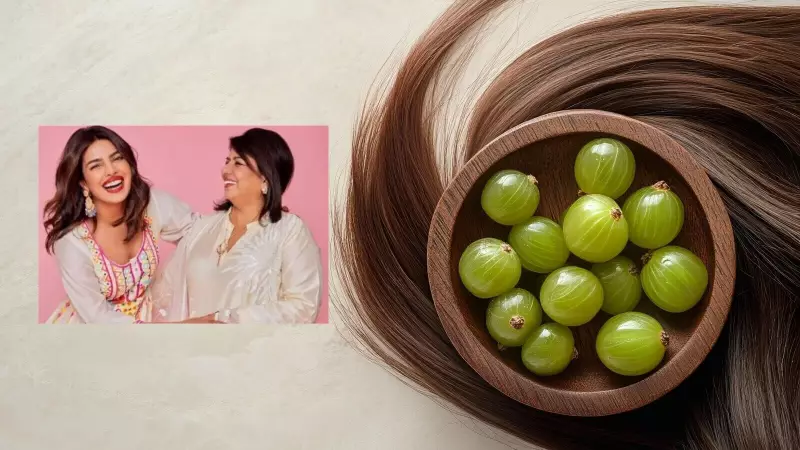 Priyanka Chopra's Mom Reveals Ancient Amla Hair Secret For Strong, Luscious Locks