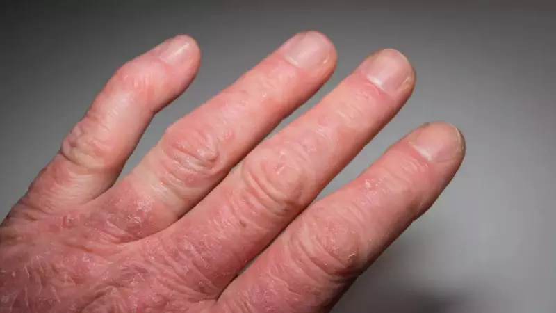 Psoriatic Arthritis: Silent Signs, Root Causes & Effective Management Strategies You Can't Ignore