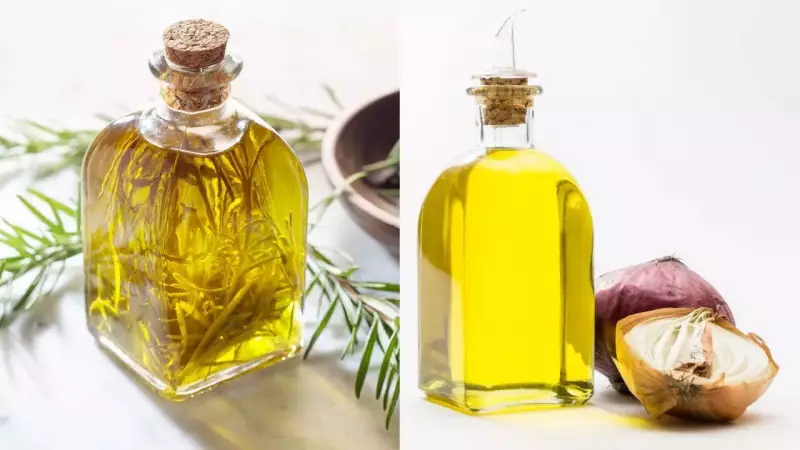Rosemary Oil vs Onion Oil: Which Is The REAL Hair Growth Champion?