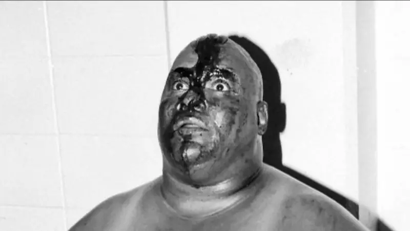 WWE Legend Abdullah The Butcher Hospitalized: Inside The Hardcore Icon's Blood-Soaked Career