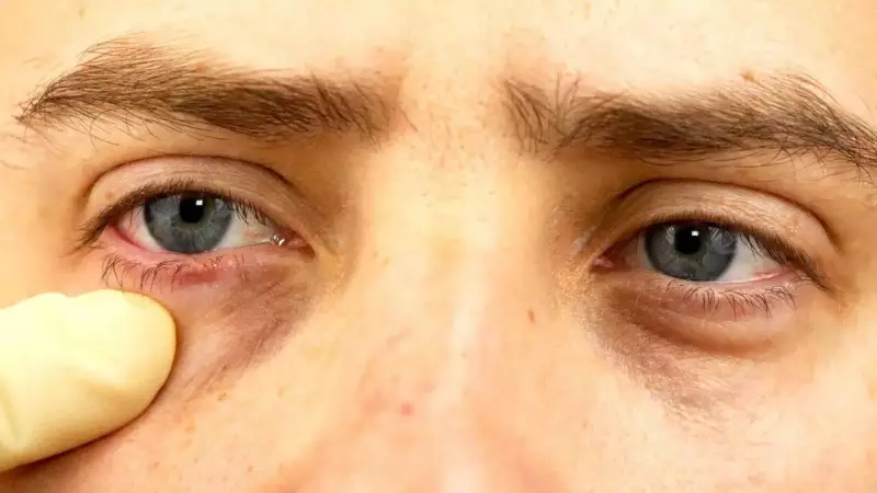 Your Eyes Are Talking: 5 Warning Signs That Reveal Hidden Health Problems