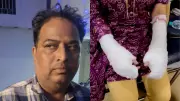 Delhi Acid Attack Hoax: Woman Fakes Assault with Toilet Cleaner, Father Faces Rape Charges