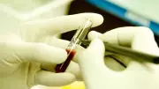 Jharkhand Medical Horror: 5 Thalassemia Children Contract HIV Through Tainted Blood Transfusions in Chaibasa