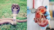 Snake Urine Breakthrough: Could This Natural Remedy Cure Kidney Stones & Gout Pain?