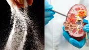 Your Daily Salt Habit Is Secretly Attacking Your Kidneys! Expert Reveals Shocking Truth