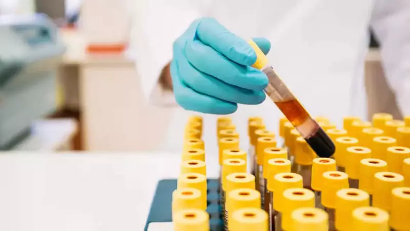 5 Hidden Biomarkers That Predict Disease Years Before Symptoms