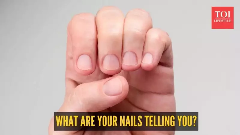 5 Nail Signs That Reveal Serious Health Issues