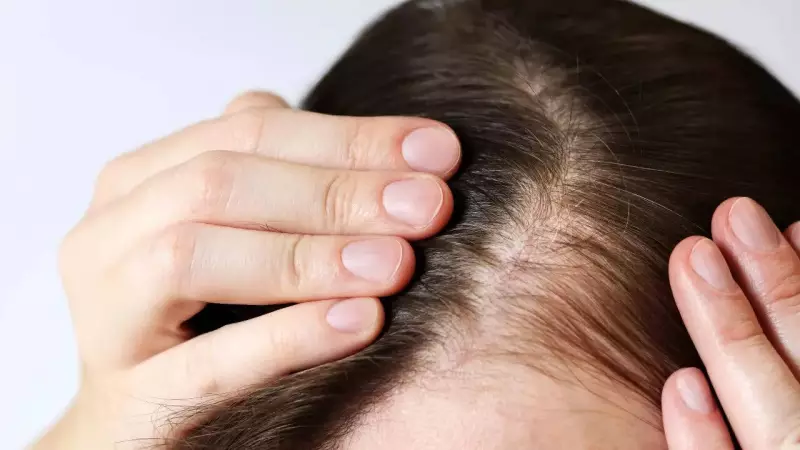 9 Facial Signs of Hormone Imbalance: What Your Face Reveals