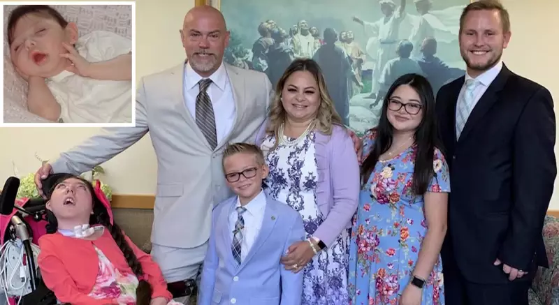 Alex Simpson Defies Doctors, Celebrates 20th Birthday with Hydranencephaly