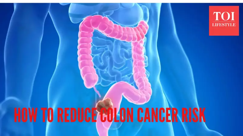 Colon Cancer: 5 Uncommon Signs & Risk Reduction Tips from Harvard Expert
