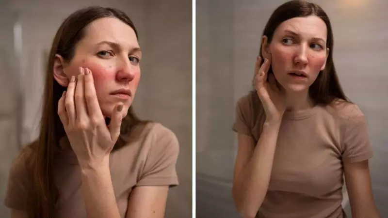 Dry Skin vs Eczema: Key Differences and Treatment Guide 2025