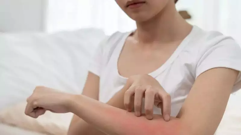 Itchy Skin? It Could Be a Silent Alarm for Kidney Trouble - Here's What You Must Know