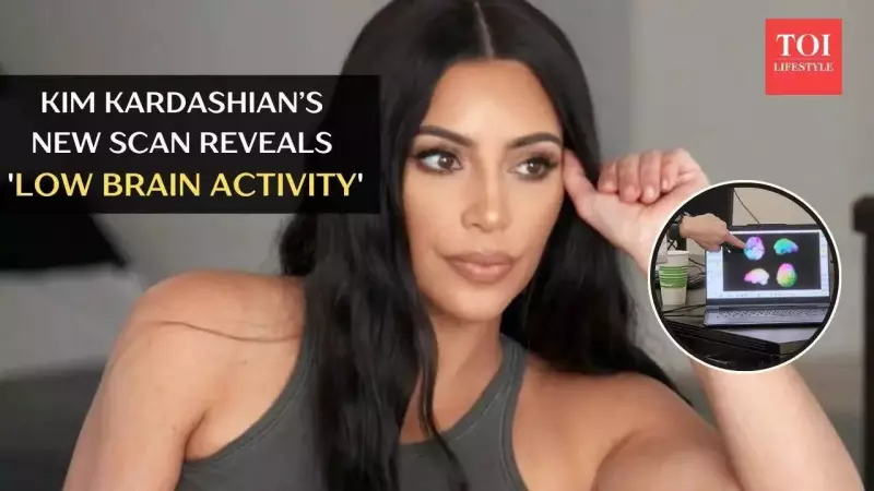 Kim Kardashian's Brain Scan Reveals Low Activity & Aneurysm Diagnosis