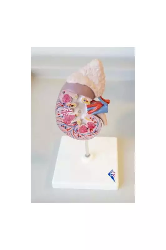 Pune Doctors Perform World's First Robotic Kidney Stone Surgery