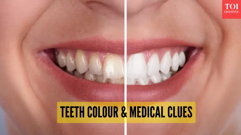 Yellow Teeth? It Could Signal Liver Issues or Diabetes