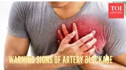 5 Early Signs of Arterial Blockage You Shouldn't Ignore