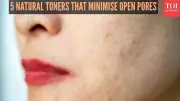 5 Natural Toners to Minimise Open Pores in Winter