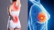 Back Pain Could Signal Breast Cancer: 7 Warning Signs Women Must Know
