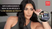 Kim Kardashian's Brain Scan Reveals Low Activity & Aneurysm Diagnosis