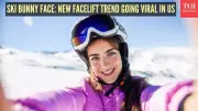 Ski Bunny Face: The $11,723 Winter Facelift Trend Sweeping Elite