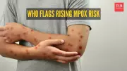 WHO Raises Alarm: Dangerous Clade Ib Mpox Strain Spreading Globally - 5 Critical Symptoms You Must Know