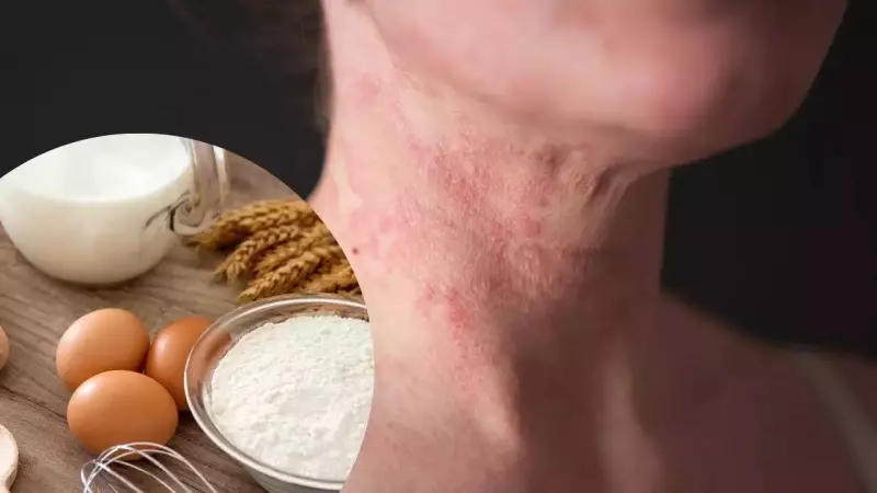 Eczema and Diet: 7 Common Food Triggers and How to Manage Them