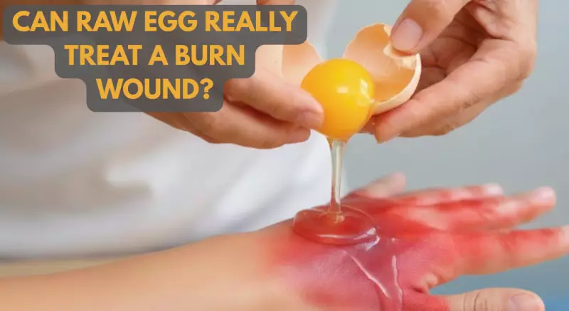 Egg White Burn Remedy: Viral Hack Debunked by Doctors as Dangerous