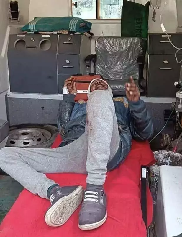 Leopard Attack in Almora: Man Injured as Wild Animal Strikes at Home