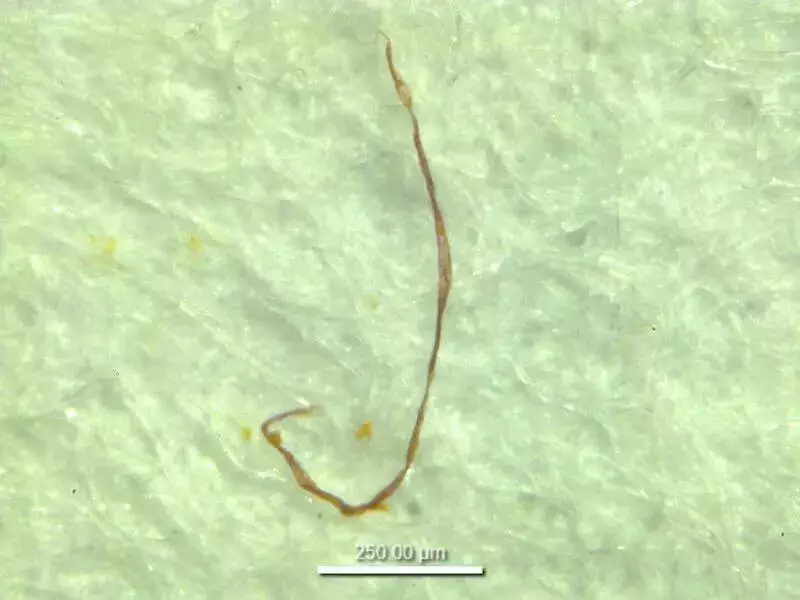 Microplastics Found in Pristine Western Ghats Lake for 50 Years, Study Reveals