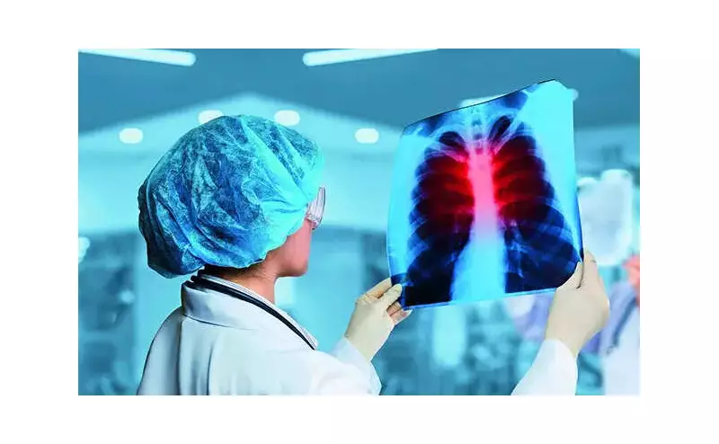 Mining Pollution Alarms: 14.3% Miners, 7.8% Residents Show Lung Damage