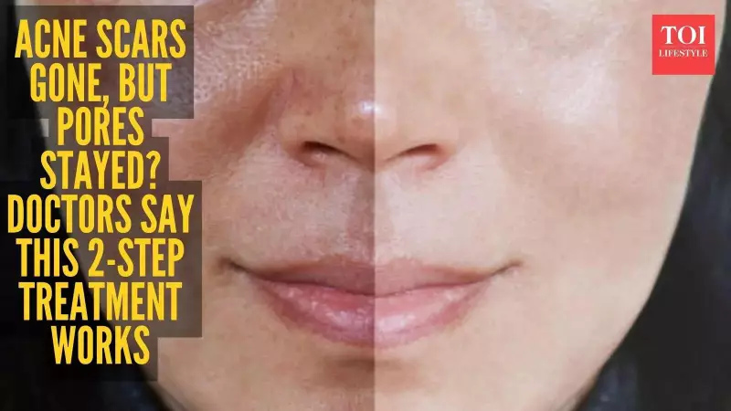 New Study: Botox & Hyaluronic Acid Combo Effectively Reduces Enlarged Pores