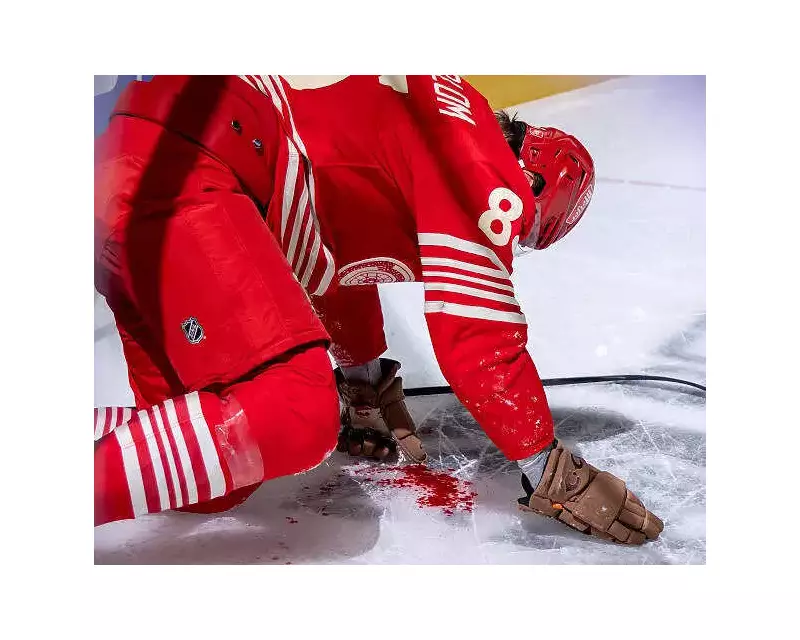 NHL Horror: Detroit's Elmer Soderblom Struck in Face by Puck, Game Halts