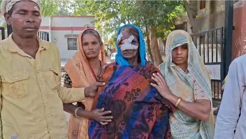 Stray Dog Terrorizes Ghughra Village in Dahod, Bites 20 Residents